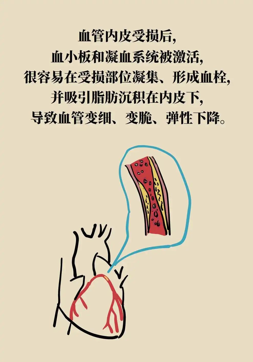 【健康图解】遇上“高糖”，警惕心肾“受伤”！