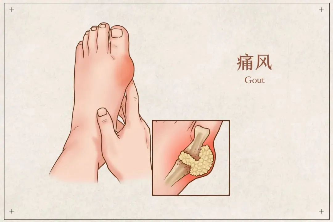 【安全科普】小龙虾虽美味,但也暗藏很大风险→ 【安全科普】小龙虾虽美味,但也暗藏很大风险→